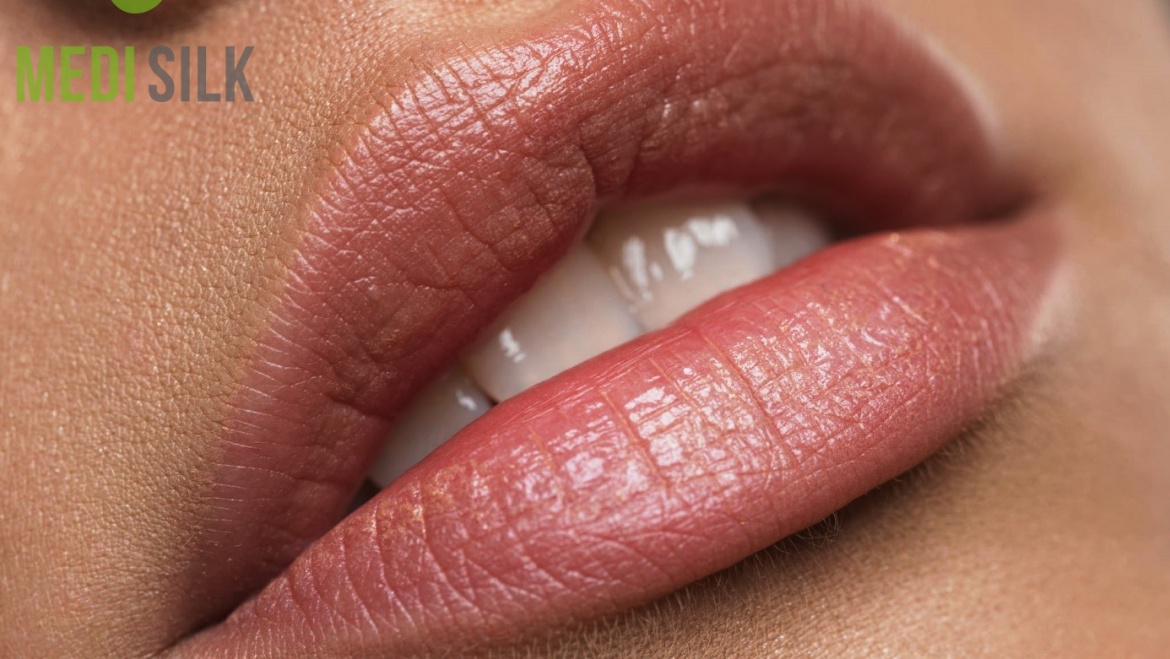 How Much Do Lip Injections Cost?