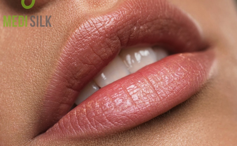How Much Do Lip Injections Cost?