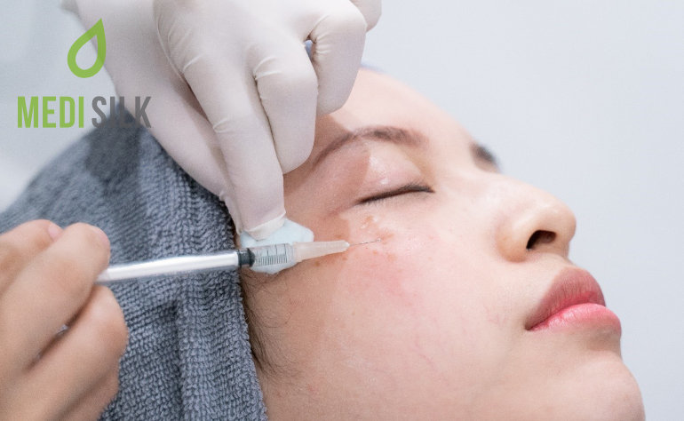 Dermal Fillers For Acne Scars The Ultimate Guide • Medisilk 6045