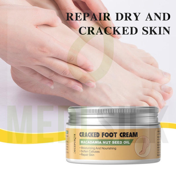 Kormesic Macadamia Nut Seed Oil Cracked Foot Cream Kormesic Macadamia Nut Seed Oil Cracked Foot Cream - Image 3