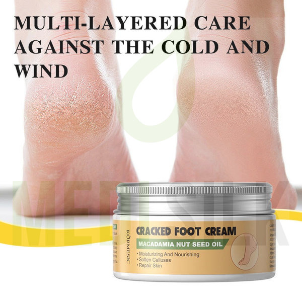 Kormesic Macadamia Nut Seed Oil Cracked Foot Cream Kormesic Macadamia Nut Seed Oil Cracked Foot Cream - Image 2